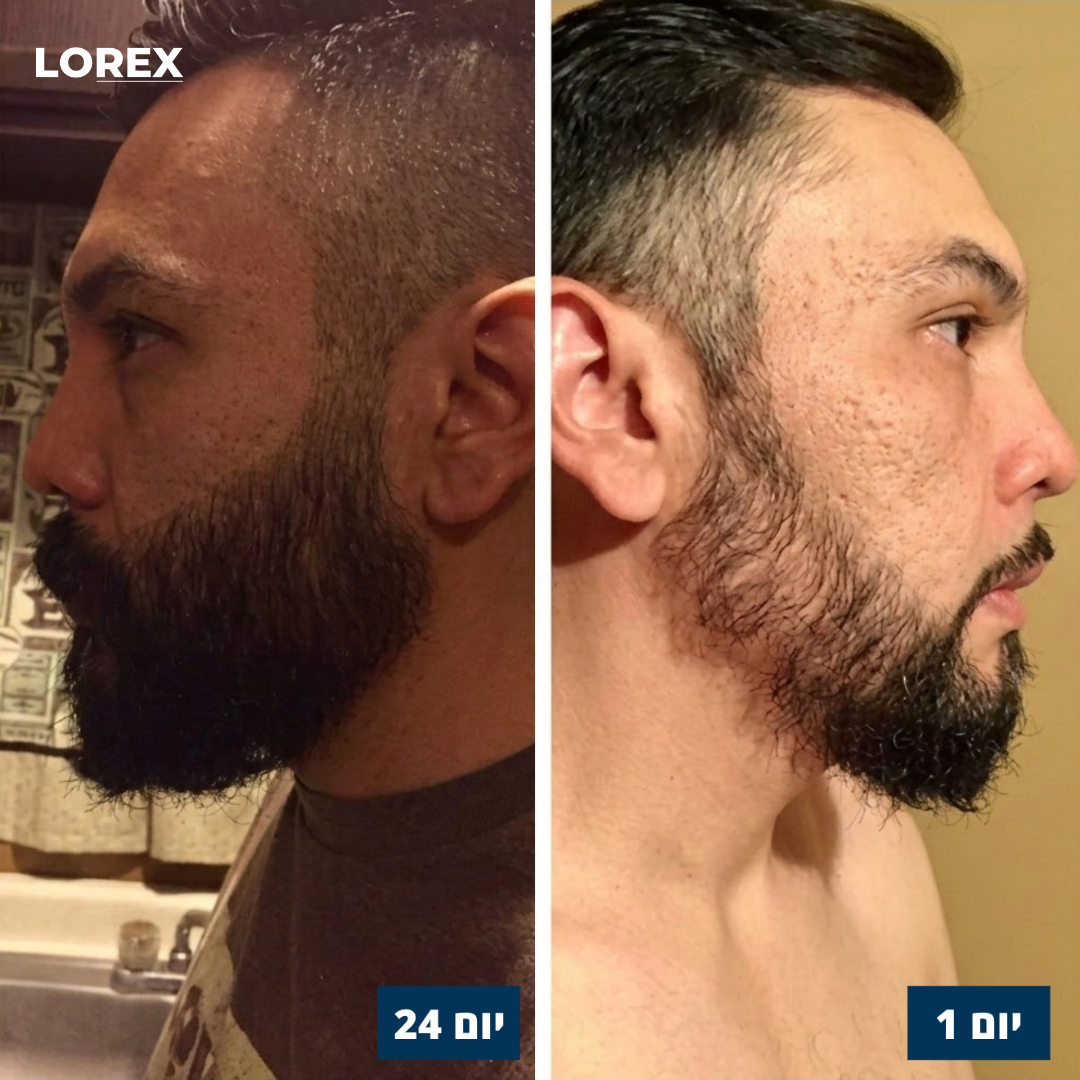 סרום לנשירת שיער - Lorex