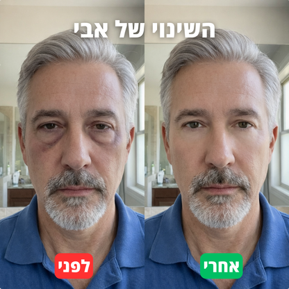 סרום לורקס לשיקום העיניים