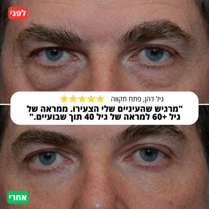 סרום לורקס לשיקום העיניים