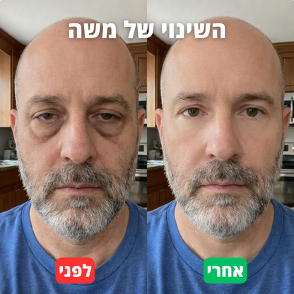 סרום לורקס לשיקום העיניים