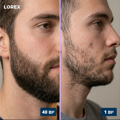 סרום לנשירת שיער - Lorex